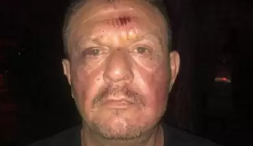 Muğla Valiliği’nden Ali Çetin’in polis tarafından darp edildiği iddiasına yalanlama