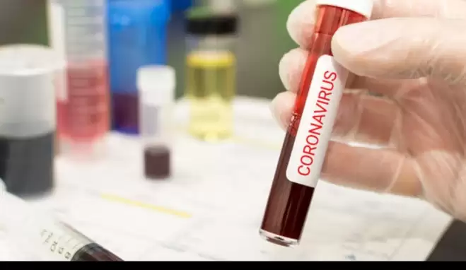 Coronavirüs belirtileri nelerdir 2020