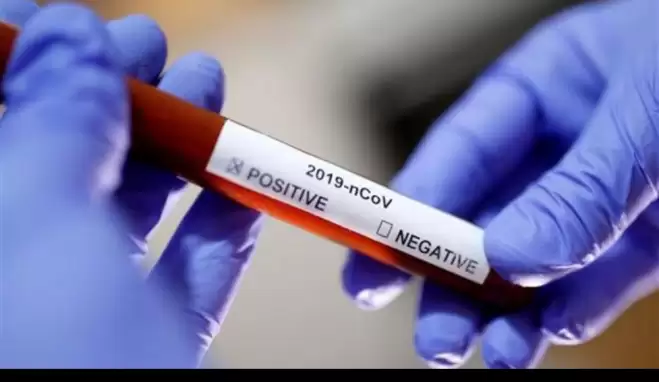 Corona Virüsü belirtileri nelerdir? Corona Virüsü nasıl anlaşılır?