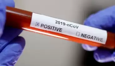 "Yoğun bakımdaki hasta sayısında artış var"