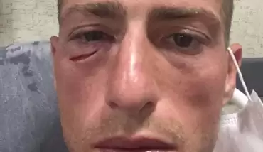 Sivasspor'dan Hakan Arslan açıklaması