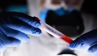 Korona hasta sayısı 400 bine yaklaştı