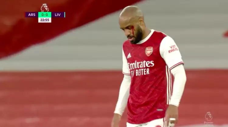 Lacazette kanlar içinde kaldı, hakem inanmadı