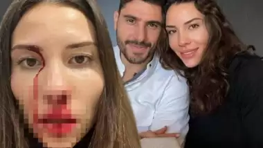 Mihriban Hurmacı, eşi Özer Hurmacı'dan gördüğü şiddet olaylarını anlattı!