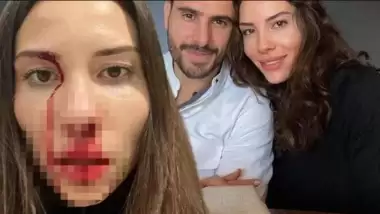 Mihriban Hurmacı'yı darp eden Özer Hurmacı hakkında yeni karar