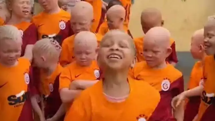 Galatasaraylı Gomis'ten Albinizm rahatsızlığı olan çocuklara hediye! 