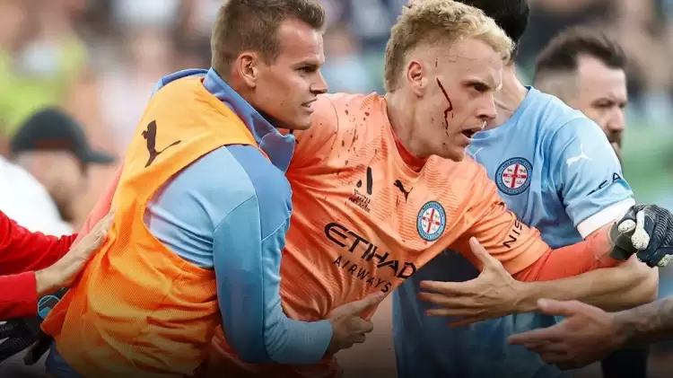 Melbourne City - Melbourne Victory Maçında Hakem ve Kaleciye Saldırdılar
