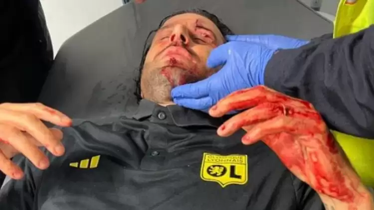 Fabio Grosso, Marsilya taraftarlarının saldırısı sonrası yaralandı!