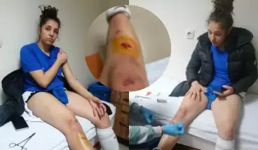 Malatyalı sporcular Adana'da saldırıya uğradı