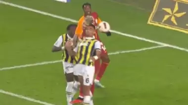 Mauro Icardi'nin gözü hangi pozisyonda morardı