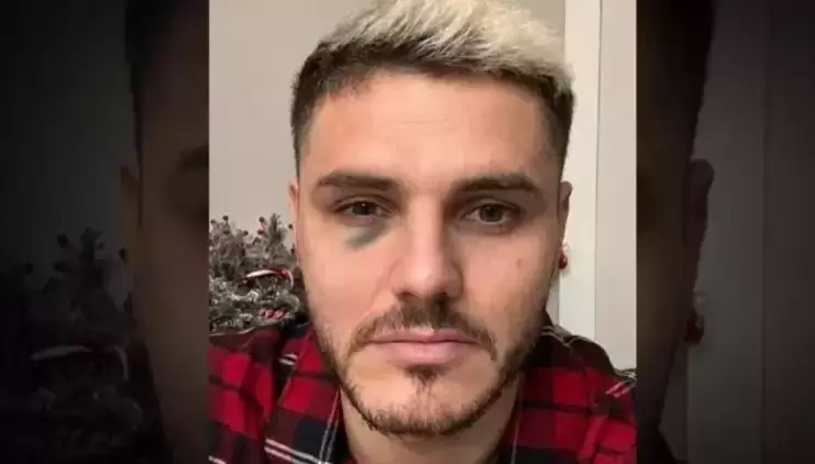 Galatasaray'da Mauro Icardi hangi maçlarda oynayamayacak?