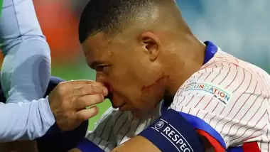 Fransa'ya Kylian Mbappe'den kötü haber!