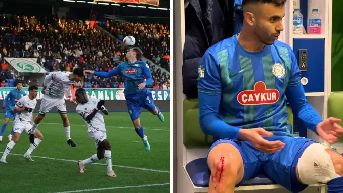 Ghezzal'ın kanlar içinde bacağını paylaştılar! "Yorumsuz"