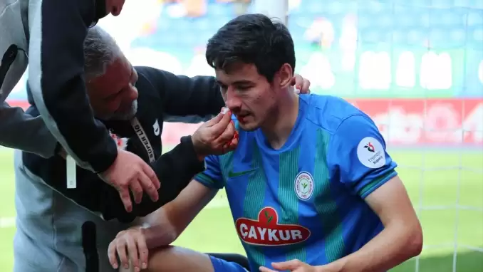 Rize'de kabus gibi ilk yarı! Alikulov'un burnu kırıldı, Samet atıldı