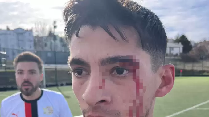 Maç sonrası saha içi savaş alanına döndü, 3 futbolcu hastanelik oldu