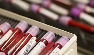 Şampiyona öncesi iki Ukraynalı'ya dopingden men!