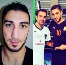 İşte estetik yaptıran 20 futbolcu.. Türkiye'den tanıdık iki isim var