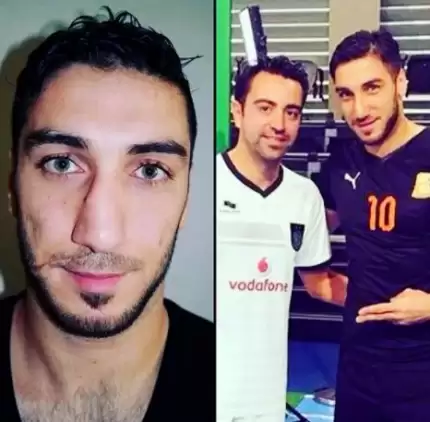 İşte estetik yaptıran 20 futbolcu.. Türkiye'den tanıdık iki isim var