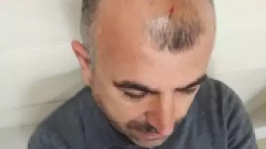 Uşakspor - Sultanbeyli Belediyespor maçı sonrası olay! Başkan yaralandı...