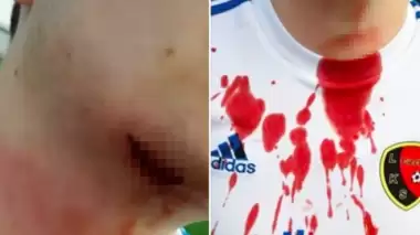 Maç sırasında inanılmaz olay!