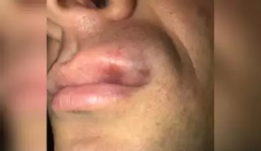 Hakeme kafa atan futbolcuya 20 maç ceza